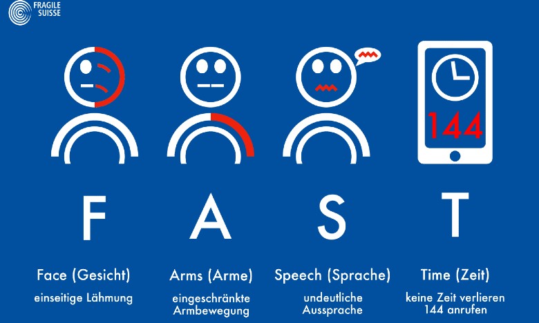 FAST-Test FAST-Test steht für: Face (Gesichtslähmung), Arms (eingeschränkte Armbewegung), Speech (Sprachstörung), Time (144 wählen)